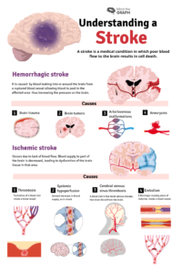 Stroke Symptoms And Risk Factors - Mind The Graph Blog