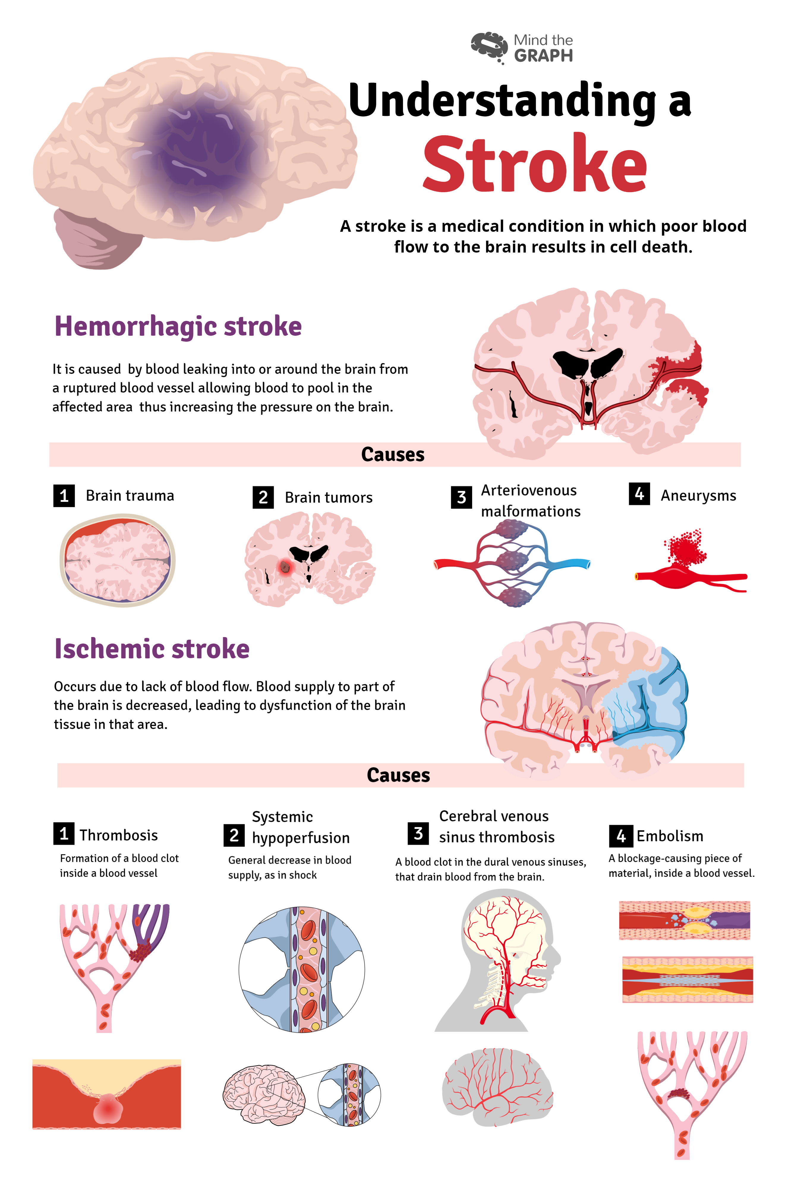 Stroke Causes Cardiology3 Mind The Graph Blog