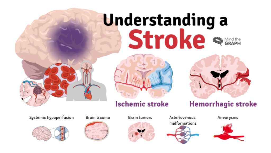 Stroke Cover4 - Mind The Graph Blog