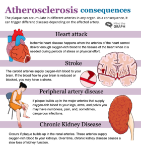 Understanding Atherosclerosis Through Medical Illustrations Mind The Graph Blog