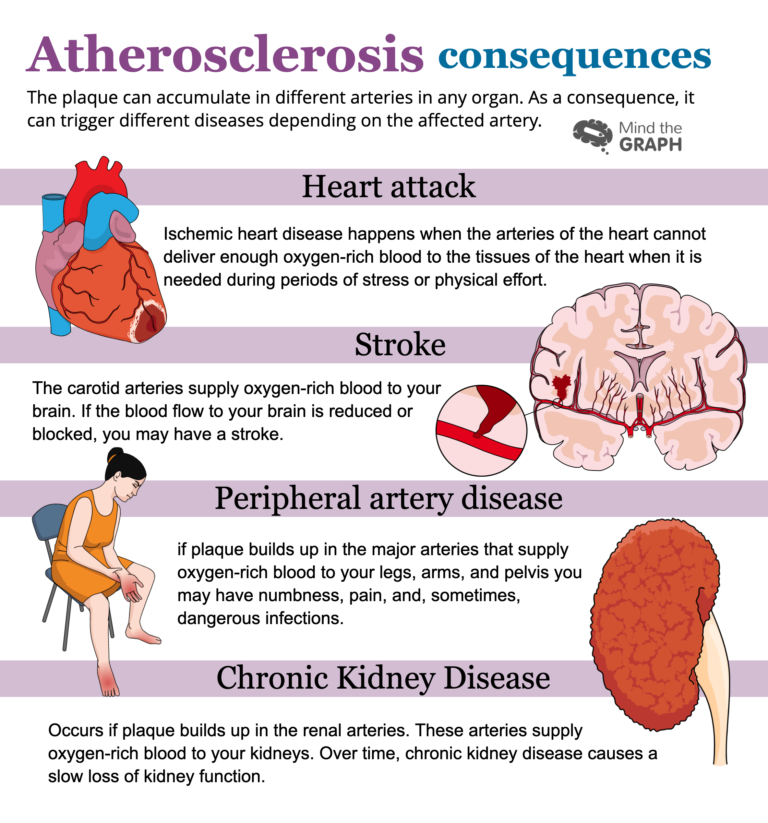 Understanding atherosclerosis through medical illustrations - Mind the ...