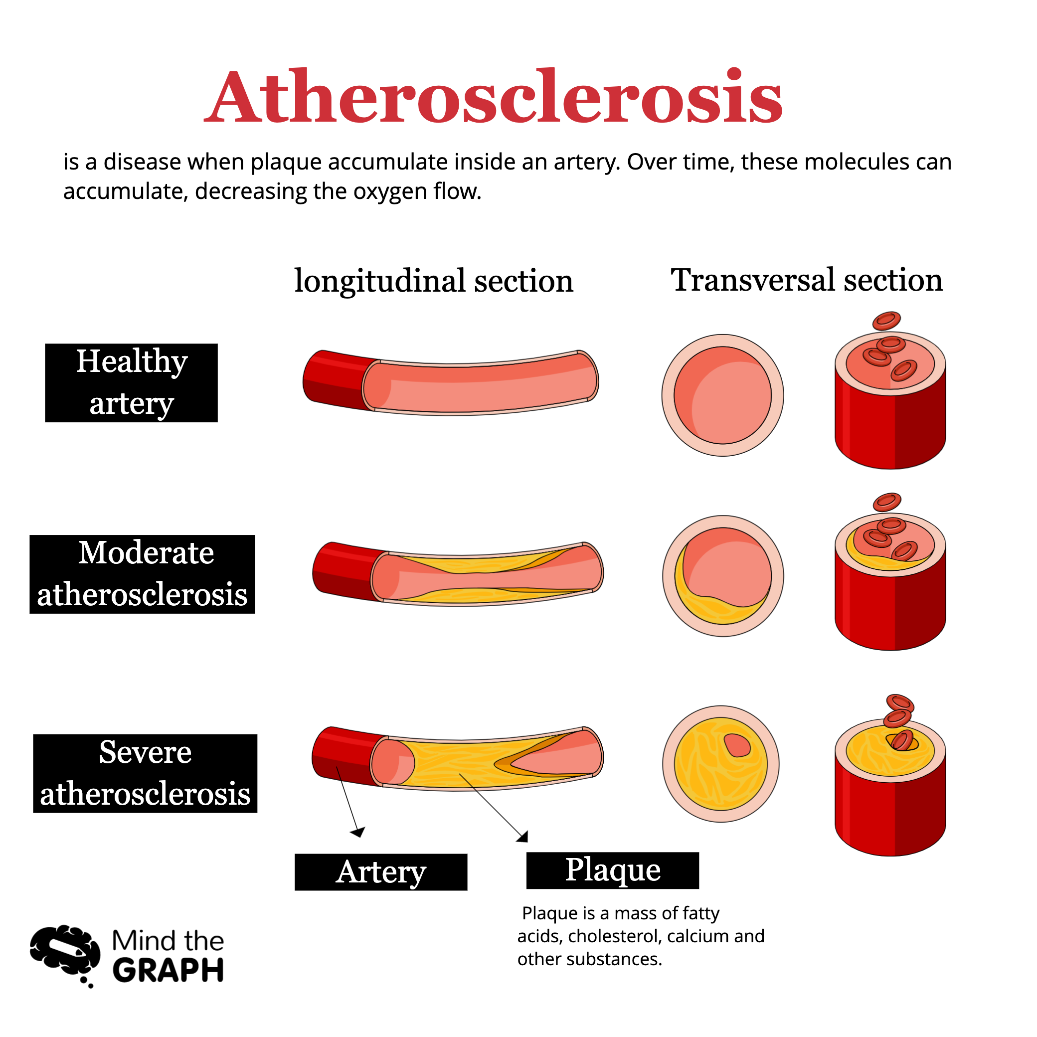 atherosclerosis - Mind the Graph Blog