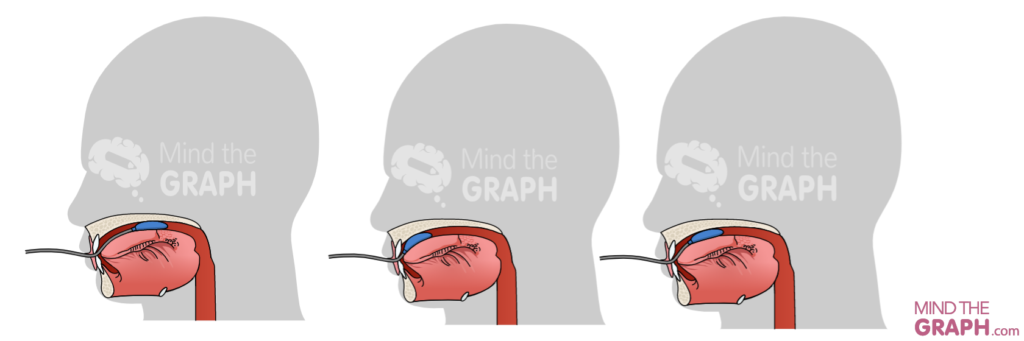 iopi tongue - Mind the Graph Blog