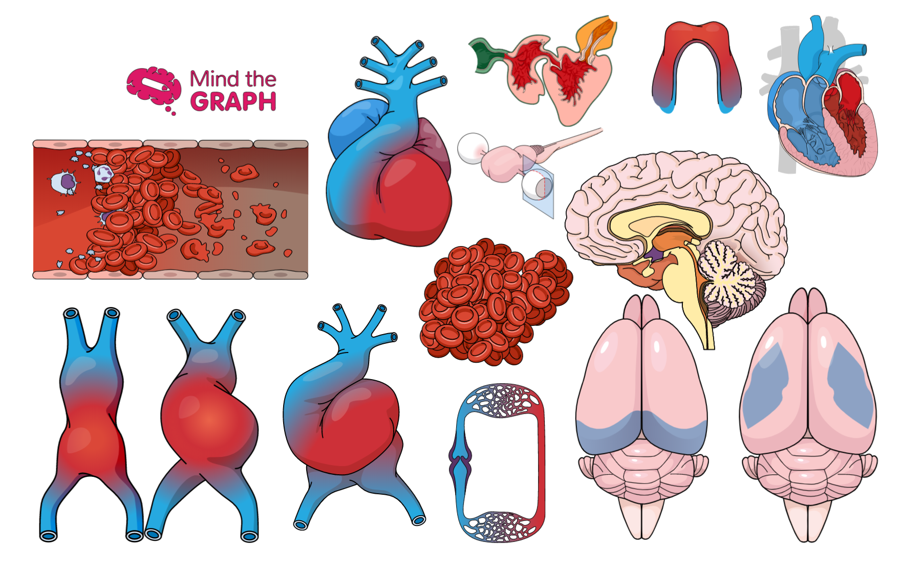 #34心脏病学插图|在线查找准确的医疗图片。