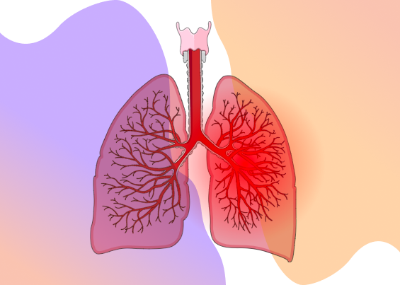 poumon pneumonie