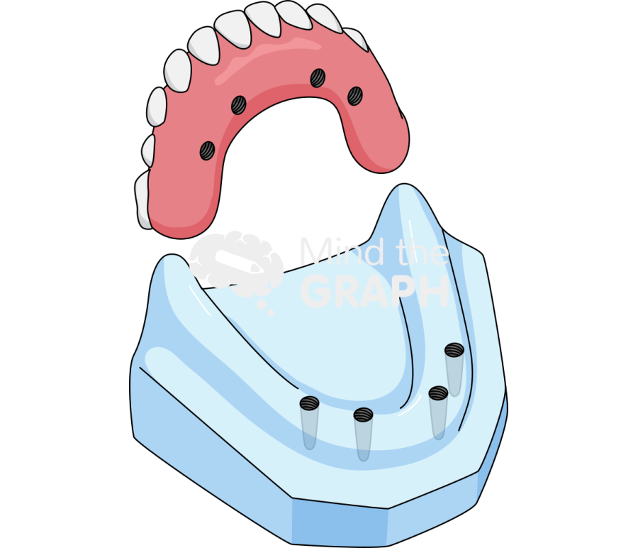 Ilustracja Mind the Graph: Proteza dentystyczna 3