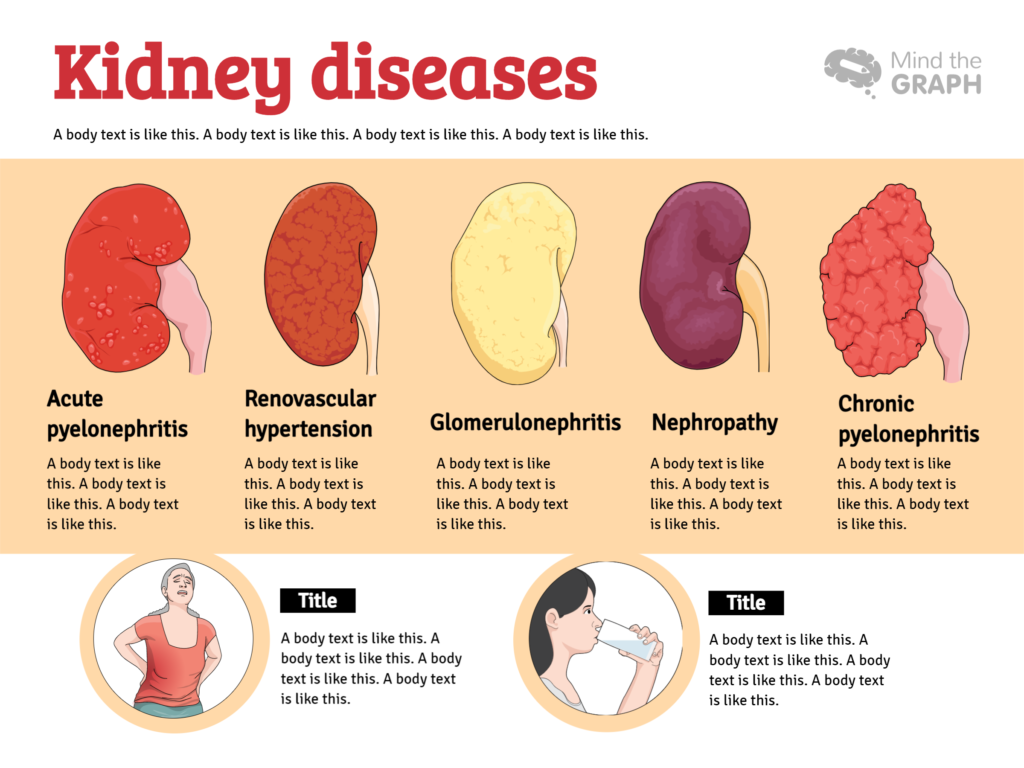 Mind the Graph template Kidney diseases.