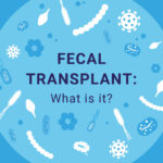 Transplante fecal: ¿qué es?