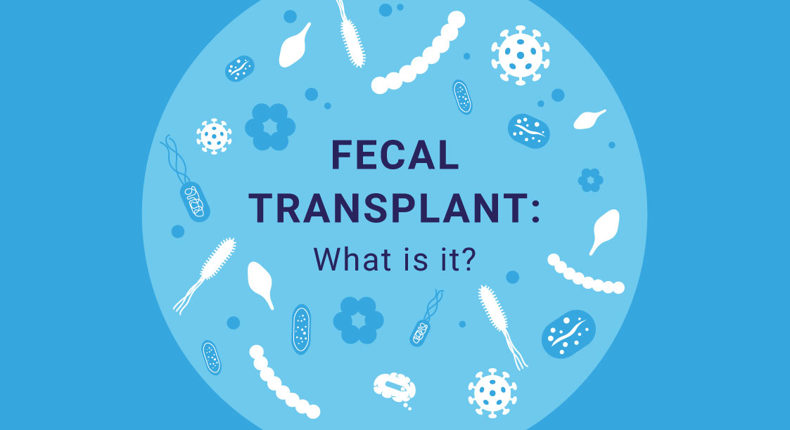 La transplantation fécale : qu'est-ce que c'est ?