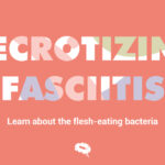 blog-necrotizare-fasciită