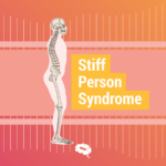 stiff person syndrome