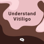 καταλαβαίνω-vitiligo-blog1
