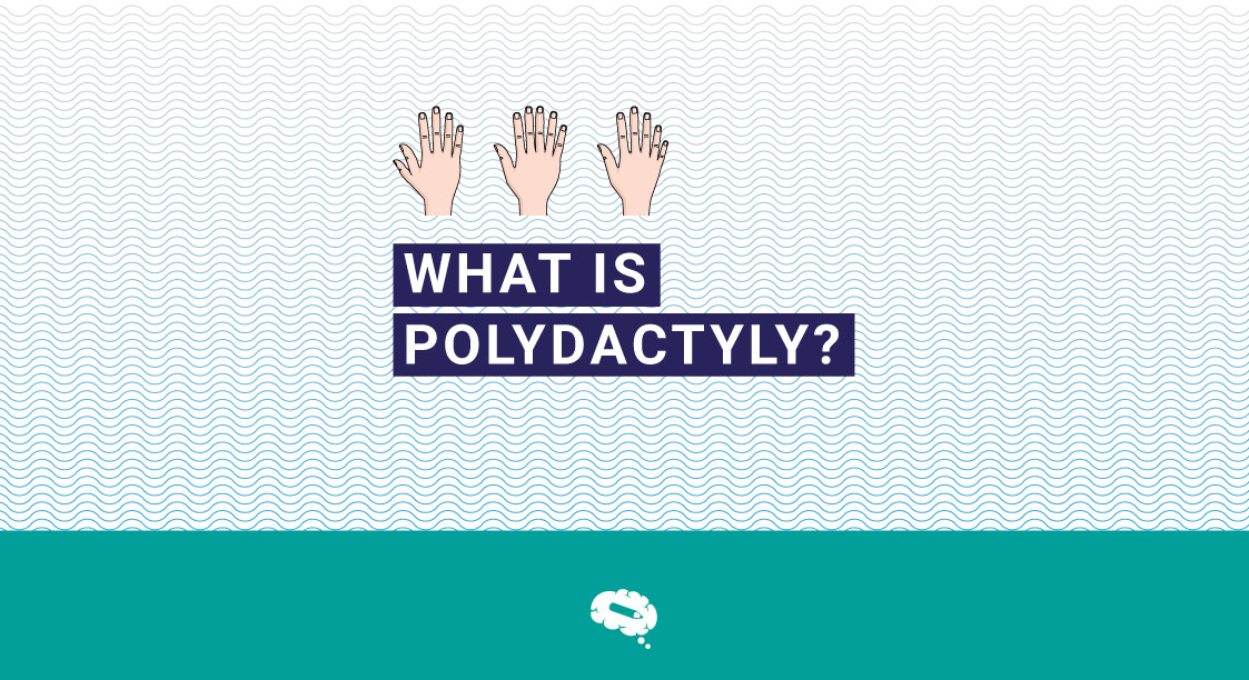 what-is-polydactyly-blog