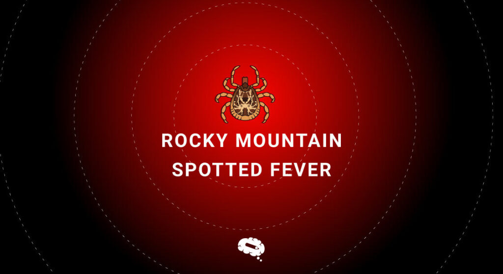Rocky Mountain Spotted Fever Blog 1024x558 